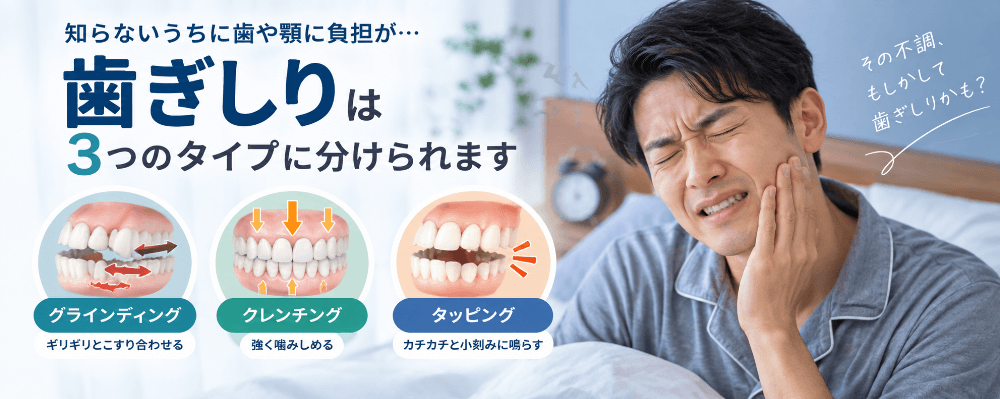 歯ぎしりの3つのタイプを示す図。ギリギリこすり合わせるグラインディング、強く噛みしめるクレンチング、カチカチ小刻みに鳴らすタッピングを、頬を押さえる男性とともに解説