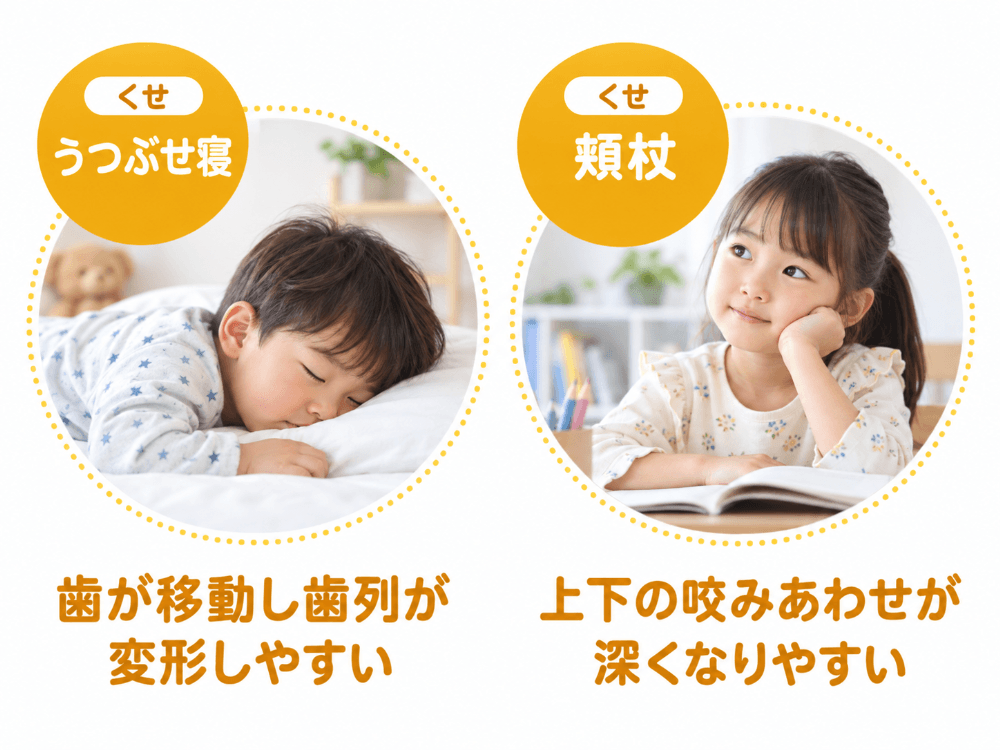 うつ伏せ寝と頬杖が歯並びや噛み合わせに影響することを示した図解