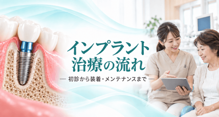 インプラント治療の流れ ― 初診から装着・メンテナンスまで。インプラントの断面図と、歯科衛生士が患者さんに治療の流れを説明している様子