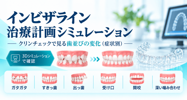 インビザライン治療計画シミュレーション集ページのアイキャッチ。叢生・すきっ歯・出っ歯・受け口・開咬など症状別のビフォーアフター