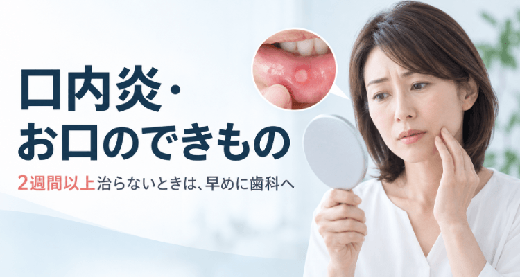 口内炎・お口のできものを歯科医師が解説するページのアイキャッチ画像。手鏡で下唇の口内炎を確認する女性と2週間ルールの注意書き