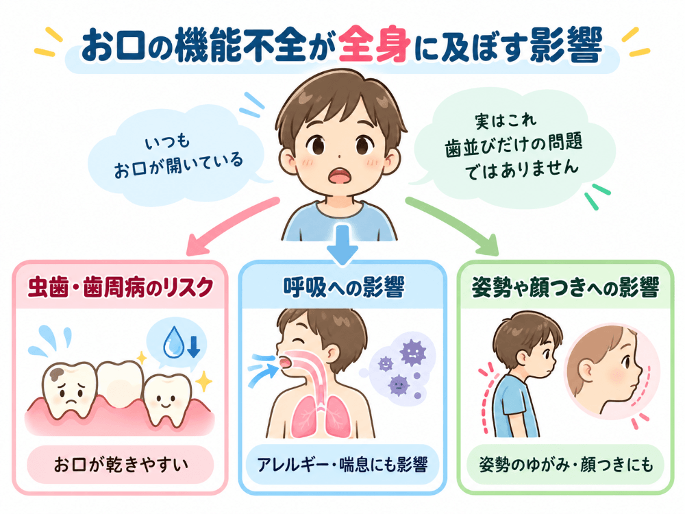お口の機能不全が全身に及ぼす影響を示したイラスト