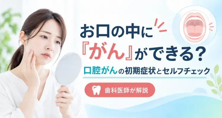 お口の中に「がん」ができる?口腔がんの初期症状とセルフチェックを歯科医師が解説するアイキャッチ画像