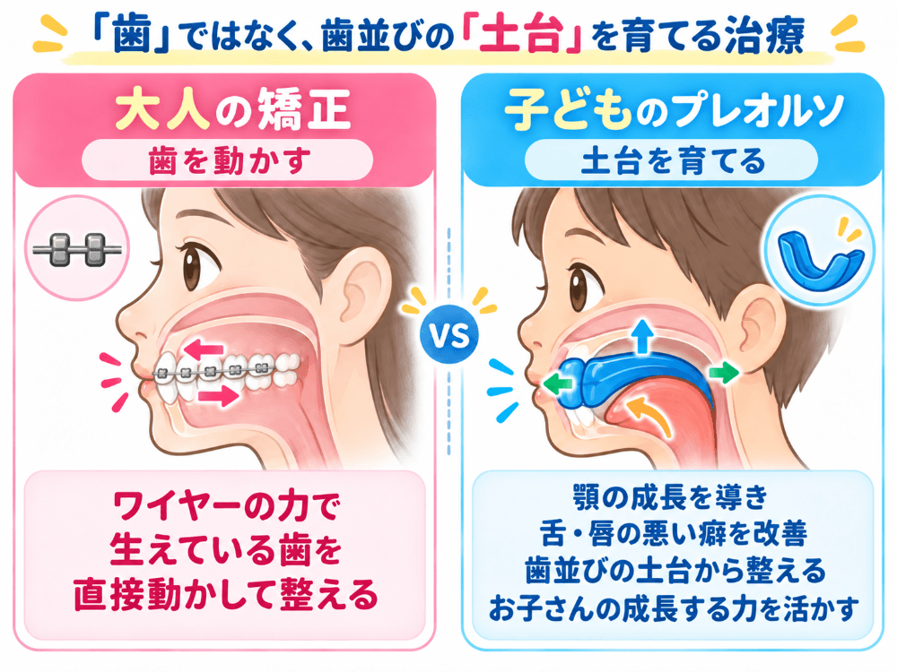 歯を動かす大人の矯正と土台を育てる子どものプレオルソの違いを示した図