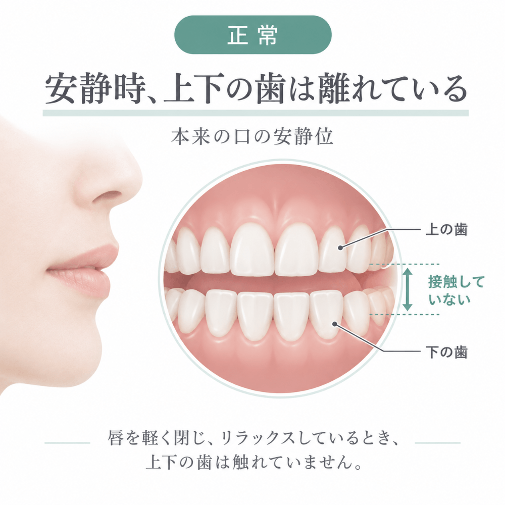 安静時は上下の歯が離れている正常な状態を示すイラスト。女性の横顔と、上下の歯が接触していない口元の拡大図