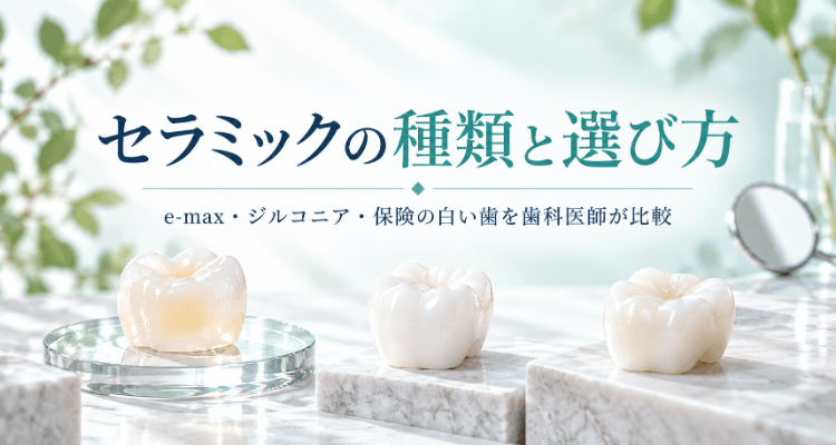 セラミックの種類と選び方｜e-max・ジルコニア・保険の白い歯を歯科医師が比較－透明感や白さの異なる3種類の被せ物を並べたイメージ