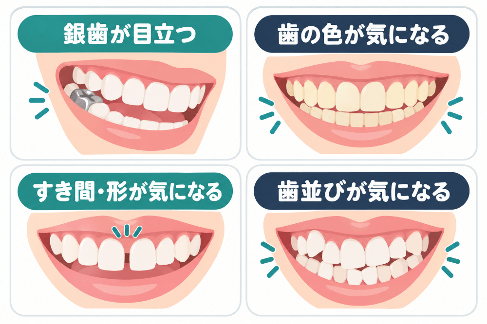 審美歯科でよくある4つのお悩み-銀歯が目立つ・歯の色・前歯のすき間や形・歯並び