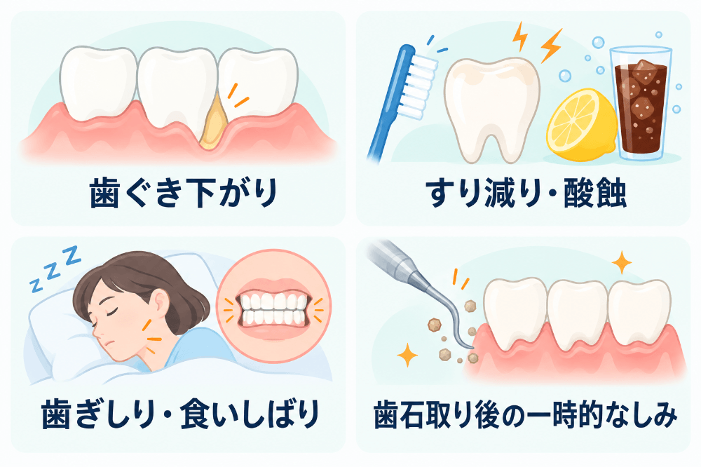 知覚過敏の主な原因の図:歯ぐき下がり、歯の表面のすり減りと酸蝕、歯ぎしり・食いしばり、歯石取り後の一時的なしみ